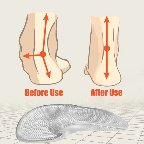 Orthopedic Silicone Gel Insoles – Shock Absorbing Arch Support Inserts